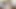 10 DAYS ARMPITS GROW HAIR EVOLUTION VIDEO