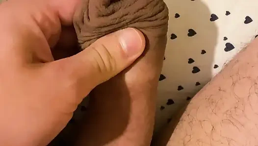 Sünnete aşırı pompalama