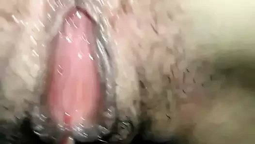 VAGINA IRRITADA