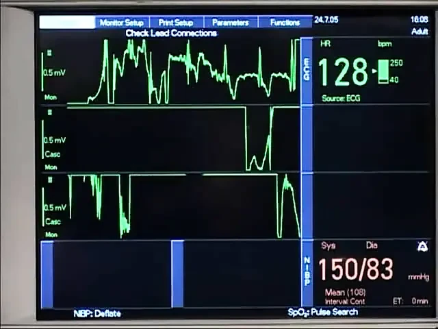 Cazzo - исследование траха