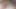 Ellili yaşlarında bol bir mazoşist, seks oyuncağını ona vidalıyor ve anal deliklere ulaşıyor, ardından oyuncak içinde sıkışmış anal sekste ölüyor