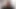 Stepmom Caught Injuired Stepson Jerking Then She Helping Him pee In Toilet