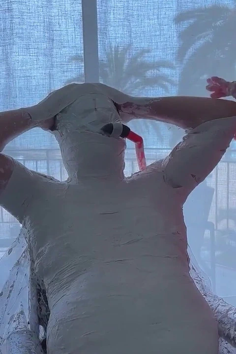 Hastane 3 - Tüm Vücut Alçısı