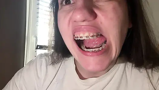 Dilinizle diş teli yalamak