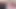 Bkr cutie doktora yaptığı ziyaretten hoşlanıyor!