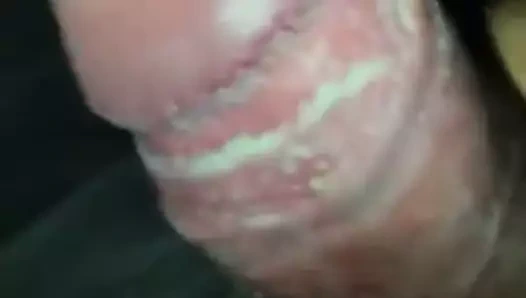 Kalın kıllı smegma çük