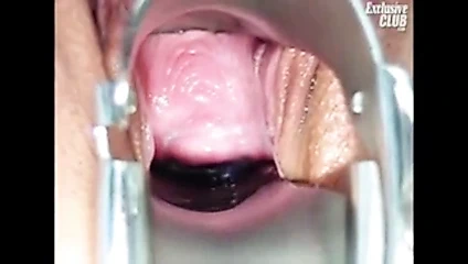 sapıkça jinekolog kliniğinde camilla gyno sandalye kedi spekulum sınavı