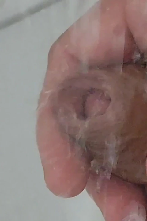 Sünnet derisindeki güçlü su, precum glans'ını heyecanlandırır.