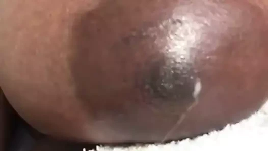 Abanoz baştankara meme ucu sızıyor