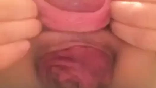 Japon sürtük - am ve eşek prolapsusu