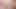 kıllı teen camgöbeği tarak pubes