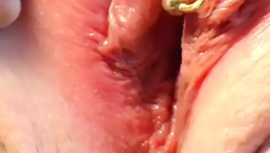 çelik yapay penis ile dava