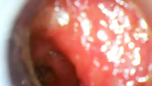 USB Endoscope ass withdraw 80cm deep