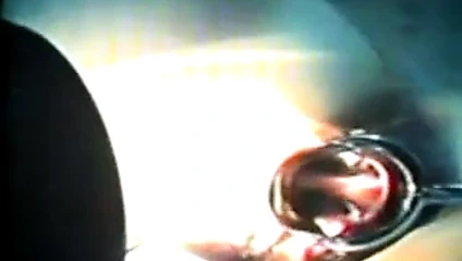 Zhangjiajing hemşireler Tayvan Tayvanlı hemşireler 02