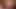 analcum 15