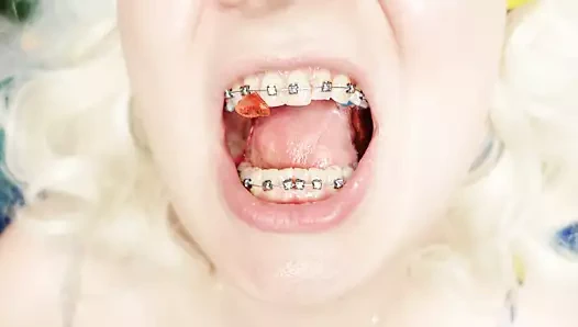 Diş telleri fetiş: yakın video mukbang.