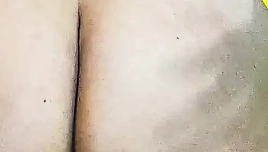 Götümdeki selülit