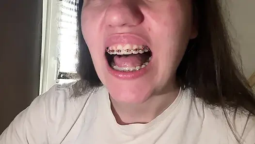 Dilinizle diş teli yalamak