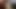 CBT Lastik Bant Esaret