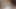 Sevimli yüzlü mii hayat hikayesini cesurca kendini özgüvenle ortaya çıkarıyor