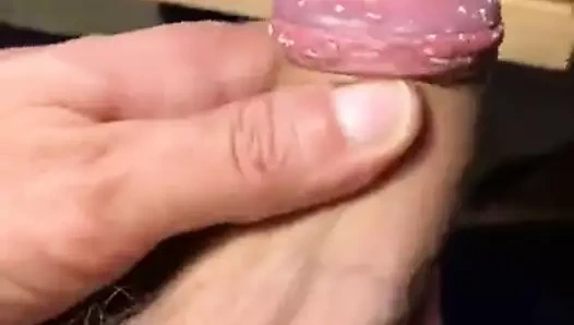 Smegma check