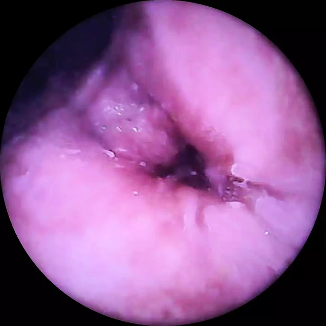 Amcığımdaki kamera