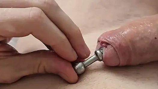 Tıkaç kaybolur ve hegar çıkarılır