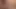 anal