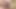Labia esnetme
