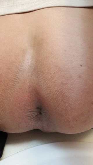 Asshole winking at you