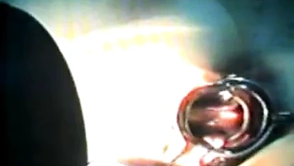 (32)zhangjiajing hemşireleri(tayvan)