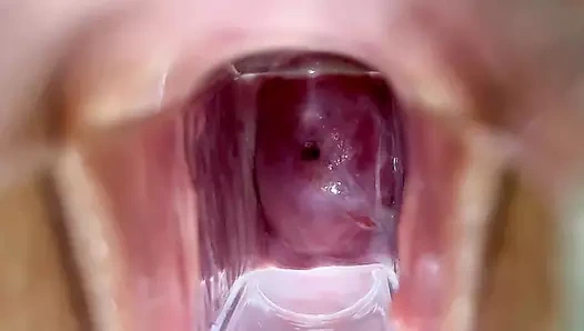 Stella st. rose - bir spekulum kullanarak aşırı rahim ağzı görünümleri ve suları akıyor