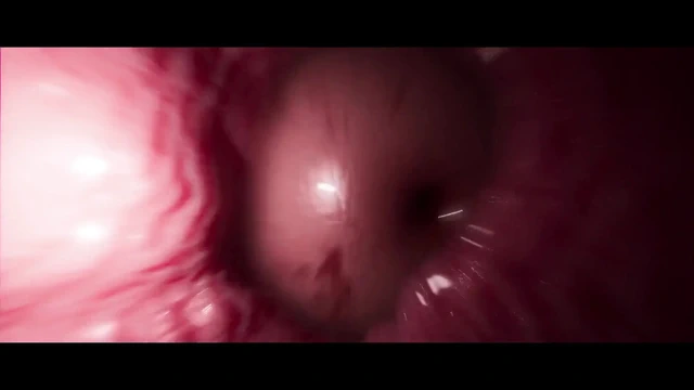 Ayakta oynama (standart - x-ray)