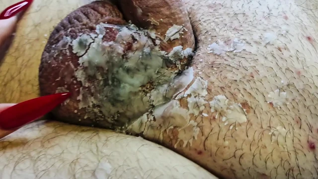 Ateşli mum ağdası cömertçe BDSM kölesinin taşaklarına ve yarağına dökülür. Erkek cinsel organlar için cbt ağda oyunu