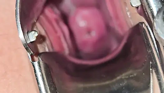 Orta yaşlı seksi kadın amını teftiş ediyor ve içine görmek için spekulum sokuyor