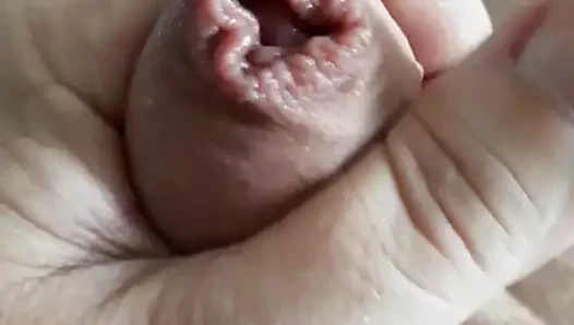 sünnet derisinde cumming