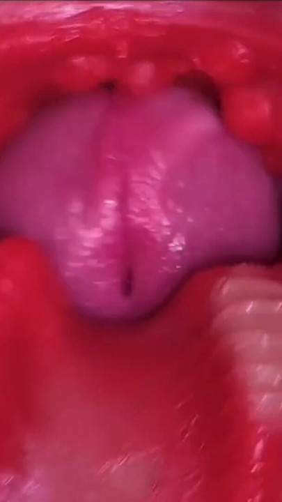 Cumfeti Damlayan Creampie Derlemesi - Endoskopik Görünüm | Clip 2