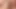 3887