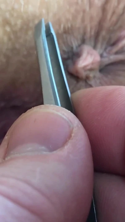 This is what happens when you ask your husband to help you remove the hair around the asshole and in the bikini area...