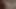 Aşağıdan beni nasıl kırdıklarını görebilirsiniz