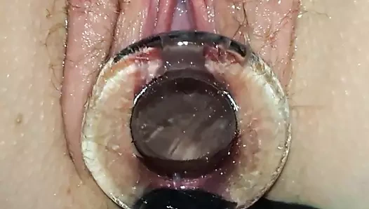 Cam delik genişletme