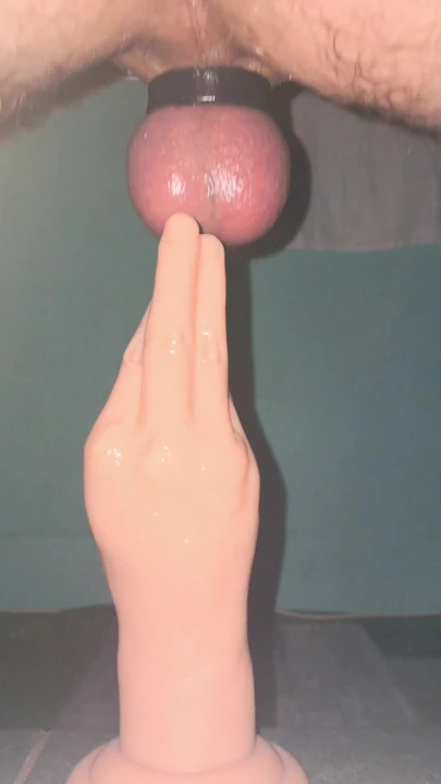 Anal mastürbasyon
