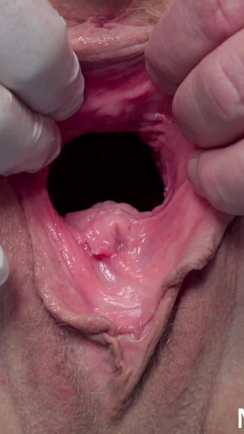 Захватывающий момент из "Медицинского осмотра обнаженной пожилой женщины"