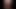 Sikimin gözlerinin önünde büyümesini izle