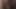 Beni duş alırken izle, iyileştiğini duydum