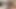 Tiktok canlı kabus - 18 yaşındaki kadının amcığı sikiş deliği kazası!