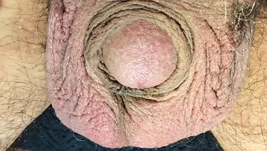 Mikropenis sallamak için çok küçük