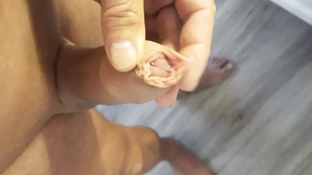 31 çekmek, harika his