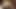 Sünnet derisinde buz bloğu + salatalık ve portakal ile anal esneme