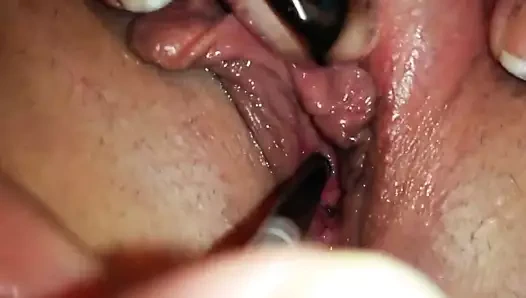 Karım idrar yolundan alıyor